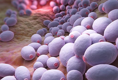 A yeast infection and bacterial vaginosis both cause vaginal discharge.