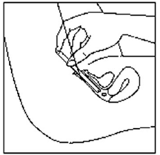 Next select the best position for vaginal insertion of Yuvafem   - Illustration