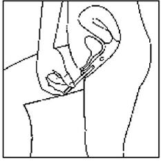 Next select the best position for vaginal insertion of Yuvafem  - Illustration