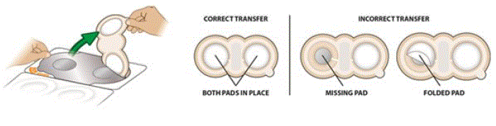 Peel the ZECUITY TDS completely away from liner - Illustration