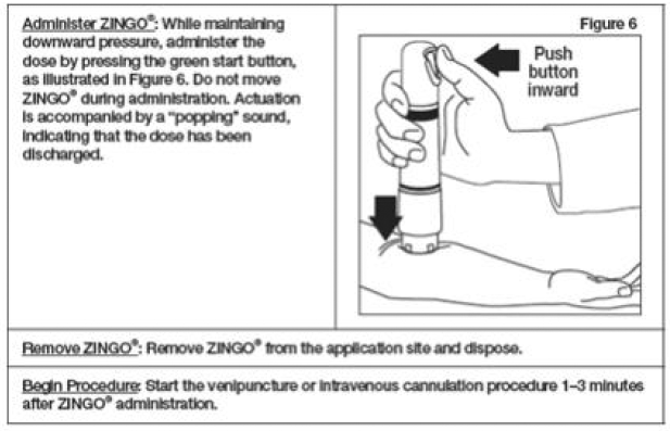 ZINGO cannot be actuated without releasing the internal
safety interlock - Illustration