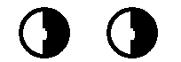 Homonymous hemianopsia