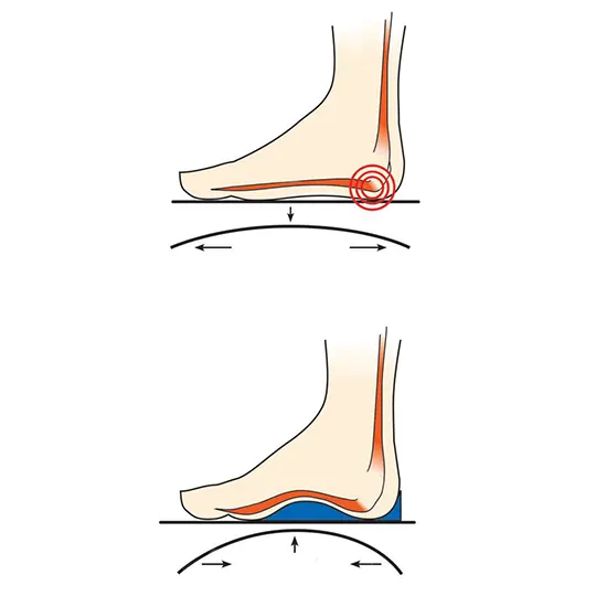 The Plantar Fasciitis Relief Rocker